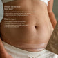 Pure Mama C-Section Scar Care Kit