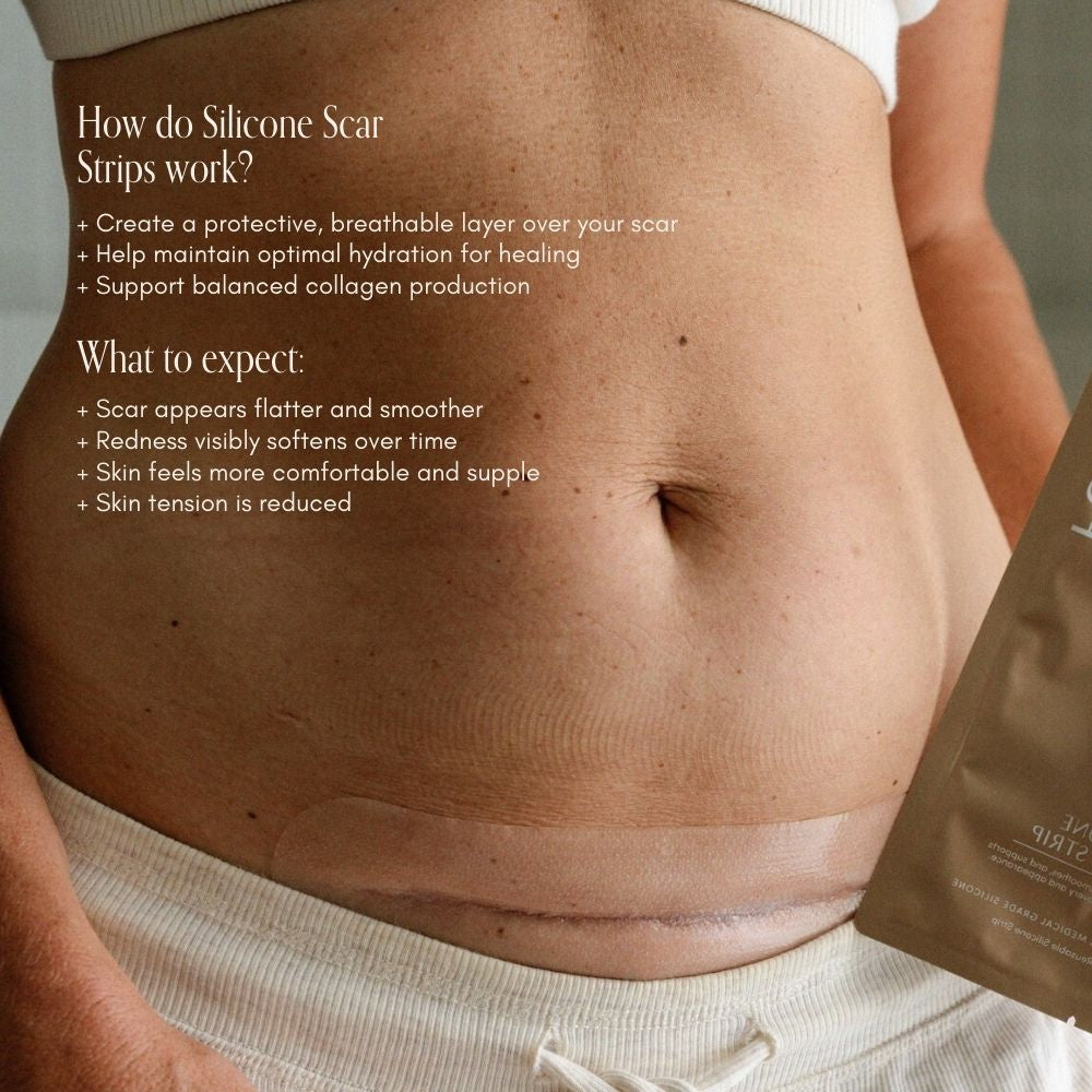 Pure Mama C-Section Scar Care Kit